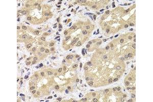 Immunohistochemistry of paraffin-embedded Human kidney using PSMD12 Polyclonal Antibody at dilution of 1:100 (40x lens). (PSMD12 抗体)