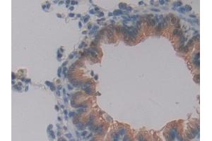 Immunohistochemistry (IHC) image for anti-Glutathione S-Transferase theta 2 (GSTT2) (AA 16-242) antibody (ABIN7432199)