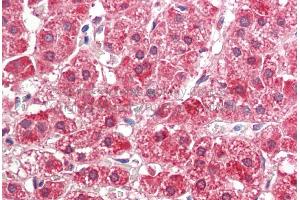 Rabbit Anti-ALDH3A2 antibody  Formalin Fixed Paraffin Embedded Tissue: Human Adult Adrenal  Observed Staining: Cytoplasm in hepatocytes Primary Antibody Concentration: 1:600 Secondary Antibody: Donkey anti-Rabbit-Cy3 Secondary Antibody Concentration: 1:200 Magnification: 20X Exposure Time: 0. (ALDH3A2 抗体  (Middle Region))