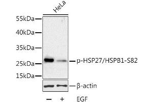 Western Blotting (WB) image for anti-Heat Shock 27kDa Protein 1 (HSPB1) (pSer82) antibody (ABIN3023550)