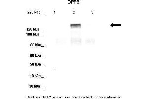 Lanes:   Lane 1: 20ug HEK-293 cell lysate Lane 2: 20ug hDPP6-YFP transfected HEK-293 lysate Lane 3: 20ug hDPP10-YFP transfected HEK-293 lysate  Primary Antibody Dilution:   1:1000  Secondary Antibody:   Donkey anti-rabbit-HRP  Secondary Antibody Dilution:   1:10,000  Gene Name:   DPP6 a  Submitted by:   Jeanne M. (DPP6 抗体  (Middle Region))