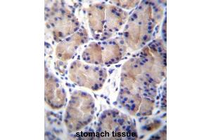 Immunohistochemistry (IHC) image for anti-Carboxylesterase 4A (CES4A) antibody (ABIN2997050) (CES4A 抗体)