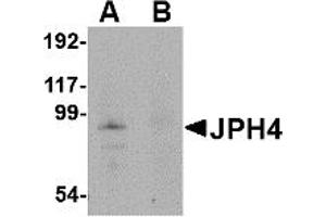 Western Blotting (WB) image for anti-Junctophilin 4 (JPH4) (Middle Region) antibody (ABIN1030971) (Junctophilin 4 抗体  (Middle Region))
