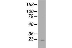 Western blot analysis of 35 µg of cell extracts from human (HeLa) cells using anti-AK1 antibody. (Adenylate Kinase 1 抗体)