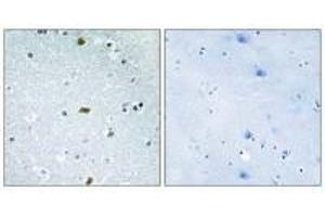 Immunohistochemistry analysis of paraffin-embedded human brain tissue, using ZFHX3 antibody. (ZFHX3 抗体)