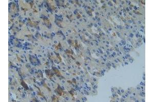 Immunohistochemistry (IHC) image for anti-Matrix Metallopeptidase 14 (Membrane-inserted) (MMP14) (AA 121-487) antibody (ABIN7434626)