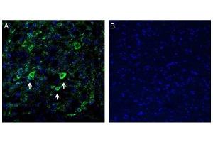 Immunohistochemistry (IHC) image for anti-Potassium Inwardly-Rectifying Channel, Subfamily J, Member 2 (KCNJ2) (AA 112-125), (Extracellular) antibody (ABIN7043481)