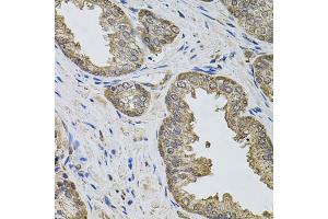 Immunohistochemistry of paraffin-embedded human prostate using IGSF3 antibody (ABIN5975786) (40x lens). (IGSF3 抗体)