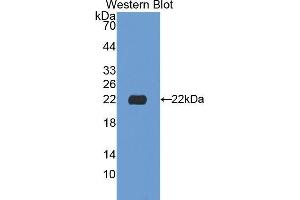 Western Blotting (WB) image for anti-Sialidase 1 (Lysosomal Sialidase) (NEU1) (AA 141-286) antibody (ABIN1174834) (NEU1 抗体  (AA 141-286))
