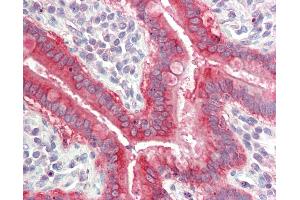 Immunohistochemistry (IHC) image for anti-Solute Carrier Family 7 (Amino Acid Transporter, L-Type), Member 8 (SLC7A8) (AA 63-112) antibody (ABIN2628428)