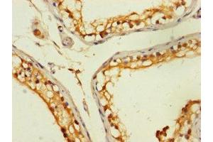 Immunohistochemistry of paraffin-embedded human testis tissue using ABIN7176385 at dilution of 1:100 (ZNF562 抗体  (AA 201-426))