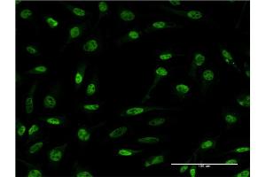 Immunofluorescence (IF) image for anti-Cerebellar Degeneration-Related Protein 2, 62kDa (CDR2) (AA 1-454) antibody (ABIN514315)