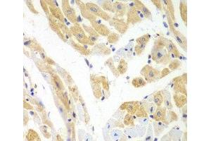 Immunohistochemistry of paraffin-embedded Mouse heart using PCBP2 Polyclonal Antibody at dilution of 1:100 (40x lens). (PCBP2 抗体)