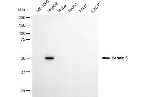Western blotting analysis using keratin 5 antibody (ABIN7799179).
