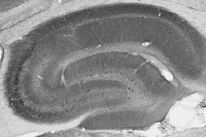 Adult rat hippocampus immunohistochemistry.