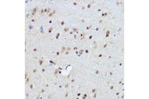 Immunohistochemistry of paraffin-embedded Mouse brain using FANCC antibody (ABIN3022593, ABIN3022594, ABIN3022595 and ABIN6218931) at dilution of 1:100 (40x lens). (FANCC 抗体  (AA 319-558))