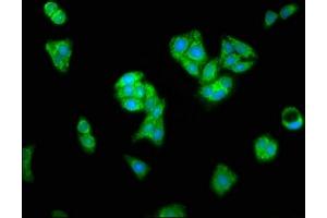 Immunofluorescence staining of HepG2 cells with ABIN7144472 at 1:466, counter-stained with DAPI.