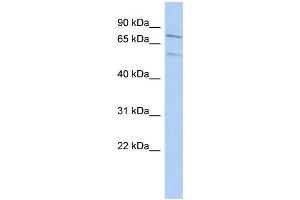 WB Suggested Anti-ZNF395 Antibody Titration: 0. (ZNF395 抗体  (Middle Region))