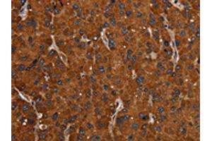 Immunohistochemistry (IHC) image for anti-Solute Carrier Family 22 (Organic Anion/urate Transporter), Member 12 (SLC22A12) antibody (ABIN7192423)