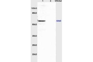 Lane 1: mouse spleen lysates Lane 2: mouse brain lysates probed with Anti APBA3/Mint3/X11 gamma Polyclonal Antibody, Unconjugated (ABIN1385696) at 1:200 in 4 °C. (APBA3 抗体  (AA 241-340))