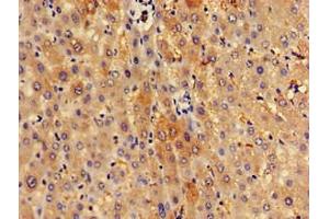 Immunohistochemistry of paraffin-embedded human liver tissue using ABIN7170645 at dilution of 1:100 (SPRED1 抗体  (AA 123-311))