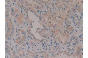 DAB staining on IHC-P; Samples: Human Kidney Tissue (CENPF 抗体  (AA 436-637))