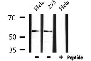 Western Blotting (WB) image for anti-ERG, ETS transcription factor (ERG) (C-Term) antibody (ABIN6261595)