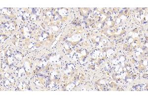 Detection of SIRT3 in Human Stomach Tissue using Monoclonal Antibody to Sirtuin 3 (SIRT3) (SIRT3 抗体  (AA 126-399))