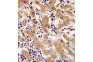 Formalin fixed and paraffin embedded human liver tissue stained with F11 Antibody (Center) followed by peroxidase conjugation of the secondary antibody and DAB staining. (Factor XI 抗体  (Middle Region))