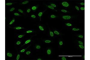 Immunofluorescence (IF) image for anti-AF4/FMR2 Family, Member 4 (AFF4) (AA 1-365) antibody (ABIN525854)