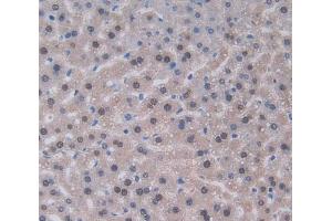 Used in DAB staining on fromalin fixed paraffin- embedded liver tissue (IL-22 抗体  (AA 34-179))