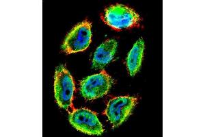 Confocal immunofluorescent analysis of Phospho-P53-S9 Antibody (ABIN1881624 and ABIN2850450) with  cell followed by Alexa Fluor 488-conjugated goat anti-rabbit lgG (green). (p53 抗体  (pSer9))