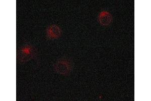 Immunofluorescence (fixed cells) (IF/ICC) image for anti-Catenin (Cadherin-Associated Protein), beta 1, 88kDa (CTNNB1) (N-Term) antibody (ABIN6260494)