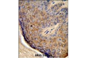 Formalin-fixed and paraffin-embedded human skin tissue reacted with TCHP Antibody (Center), which was peroxidase-conjugated to the secondary antibody, followed by DAB staining. (TCHP 抗体  (AA 291-320))