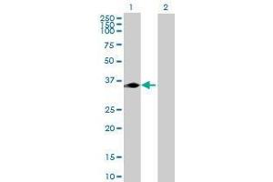 Lane 1: KCTD7 transfected lysate ( 33. (KCTD7 293T Cell Transient Overexpression Lysate(Denatured))