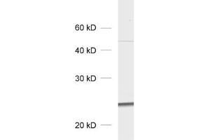 dilution: 1 : 1000, sample: total cell lysate of GFP transfected fibroblasts