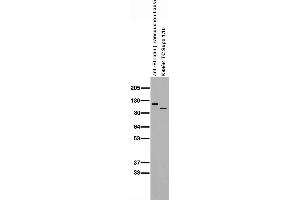 Immunoblot on adult rat brain membranes in comparison with commercial anti-Striatin antibody.