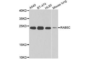 Western blot analysis of extracts of various cell lines, using RAB5C antibody. (Rab5c 抗体  (AA 1-216))