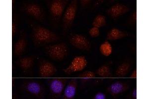 Immunofluorescence analysis of L-929 cells using PCGF1 Polyclonal Antibody at dilution of 1:100. (PCGF1 抗体)