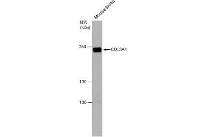 WB Image COL3A1 antibody [C2C3], C-term detects COL3A1 protein by western blot analysis. (COL3A1 抗体  (C-Term))