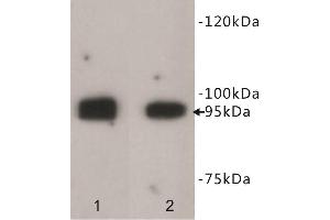 Western Blotting (WB) image for anti-Leucine-Rich Repeat Containing G Protein-Coupled Receptor 5 (LGR5) antibody (ABIN1854936)