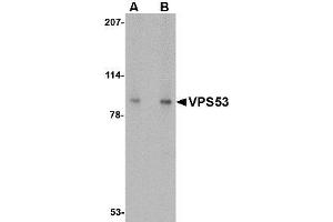 Image no. 1 for anti-Vacuolar Protein Sorting 53 Homolog (VPS53) (C-Term) antibody (ABIN1492163)