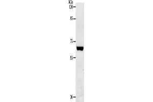 Gel: 8 % SDS-PAGE, Lysate: 40 μg, Lane: Jurkat cells, Primary antibody: ABIN7192880(TRAF7 Antibody) at dilution 1/300, Secondary antibody: Goat anti rabbit IgG at 1/8000 dilution, Exposure time: 2 minutes (TRAF7 抗体)