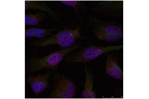 Image no. 3 for anti-Nuclear Factor-kB p65 (NFkBP65) (Ser276) antibody (ABIN197110) (NF-kB p65 抗体  (Ser276))