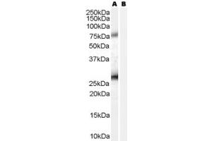 Western Blotting (WB) image for anti-Estrogen Receptor Binding Site Associated, Antigen, 9 (EBAG9) (C-Term) antibody (ABIN185657)