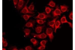 ABIN6273990 staining HepG2 by IF/ICC. (ALAS1 抗体  (Internal Region))