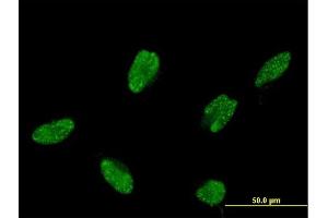 Immunofluorescence of monoclonal antibody to ASCL1 on HeLa cell. (ASCL1 抗体  (AA 137-236))