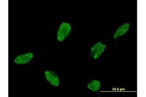 Immunofluorescence of monoclonal antibody to ASCL1 on HeLa cell.