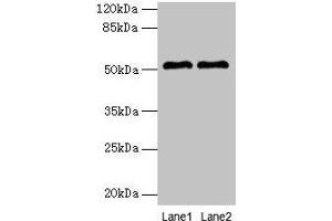 Western blot All lanes: SLC30A6 antibody at 6 μg/mL Lane 1: A549 whole cell lysate Lane 2: U251 whole cell lysate Secondary Goat polyclonal to rabbit IgG at 1/10000 dilution Predicted band size: 52, 56, 48, 49 kDa Observed band size: 52 kDa (SLC3A6 (AA 246-461) 抗体)