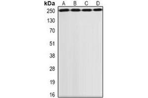 Western blot analysis of GCN2 expression in SKOV3 (A), HepG2 (B), MCF7 (C), rat lung (D) whole cell lysates. (GCN2 抗体)